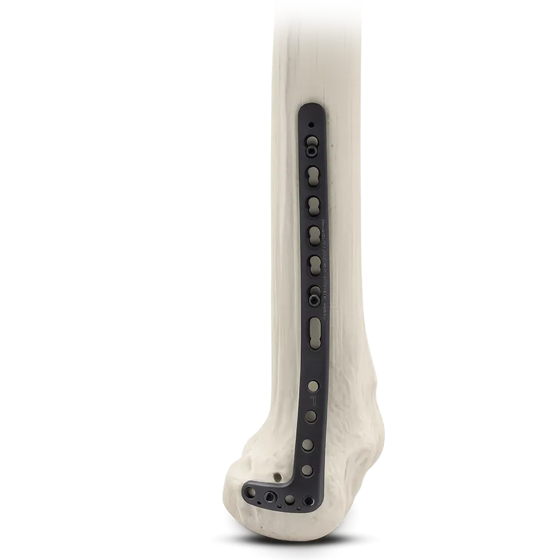 Locking Proximal Tibia Plate with bone
