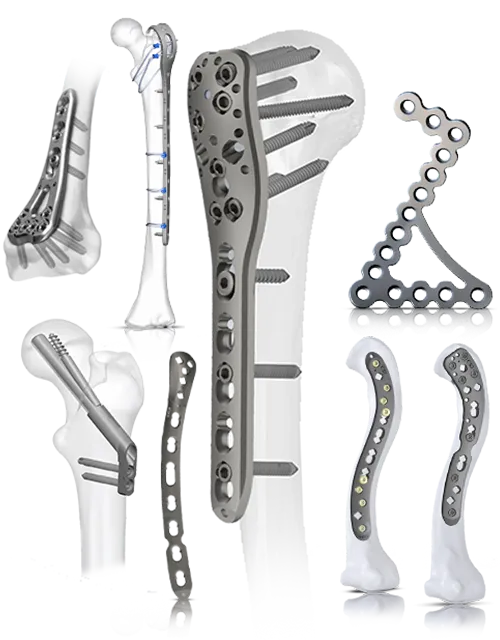 Orthopedic Locking Plate Systems