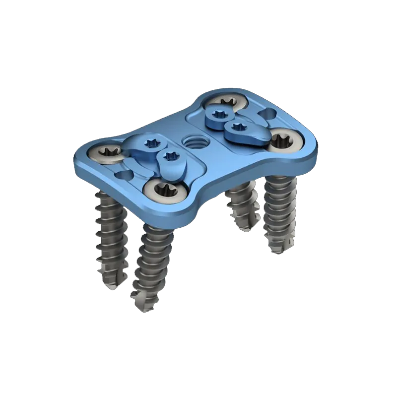 Anterior Cervical Plate One – Level