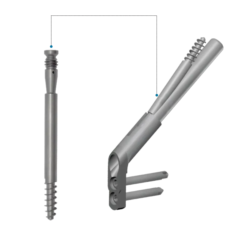 FNS – Antirotation Leg Screw - Titanium