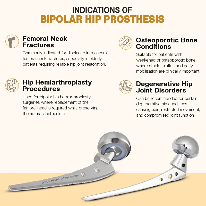 Key Indications of Bipolar Hip Prosthesis