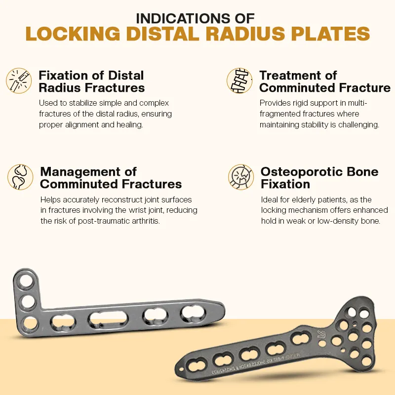 Key Indications of Distal Radius Plates