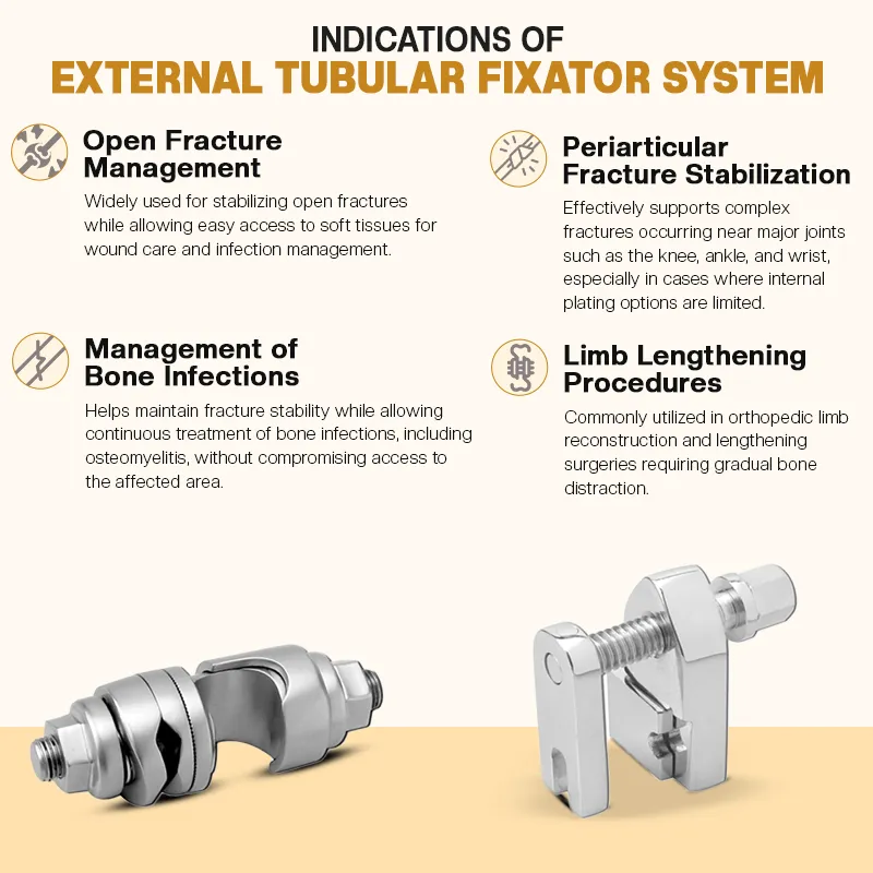 Key Indications of External Tubular Fixator System