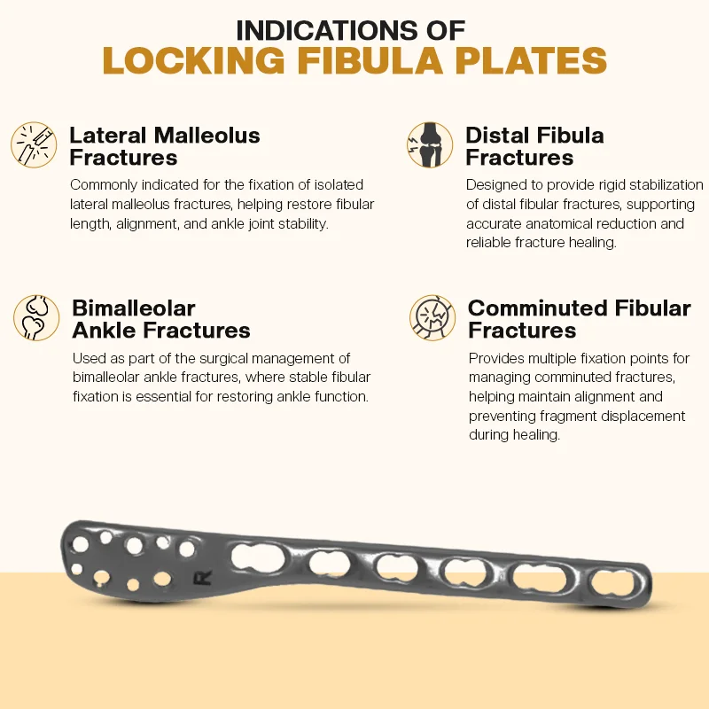 Key Indications of Locking Fibula Plates