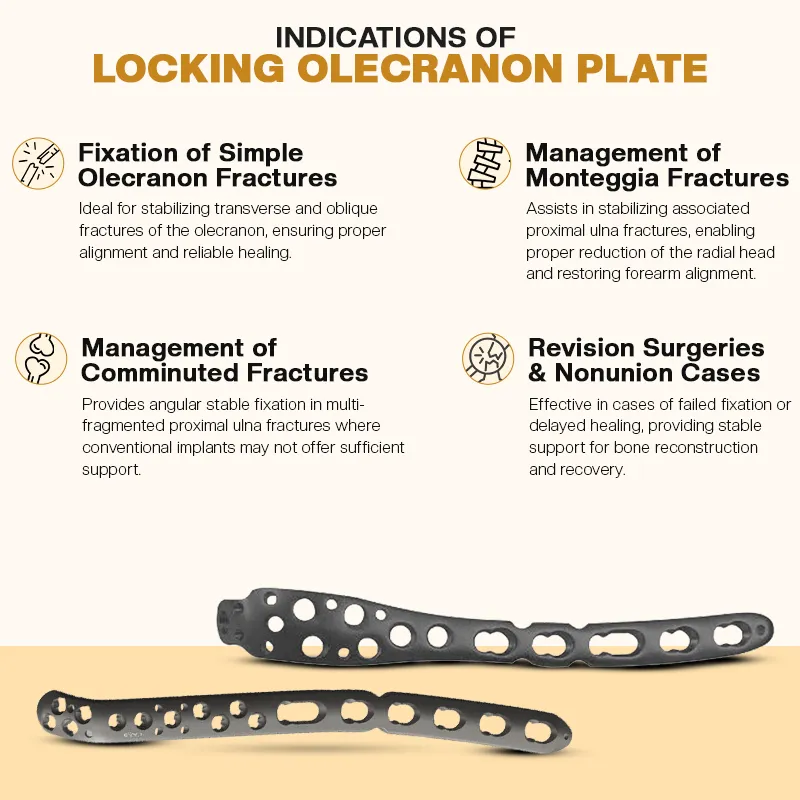 Key Indications of Olecranon Locking Plate