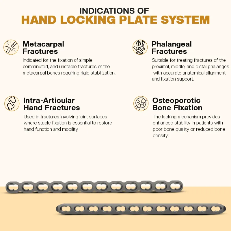Key Indications of Orthopedic Hand Plate Locking System