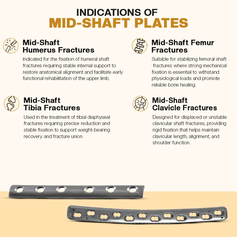 Key Indications of Orthopedic Mid-Shaft Plates