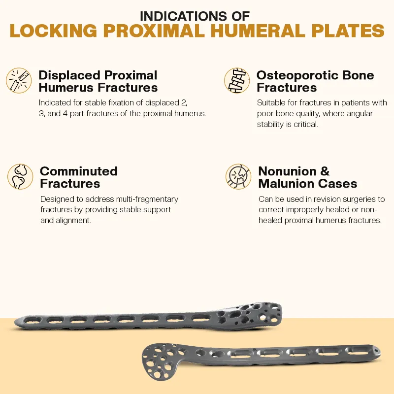 Key Indications of Proximal Humerus Locking Plates