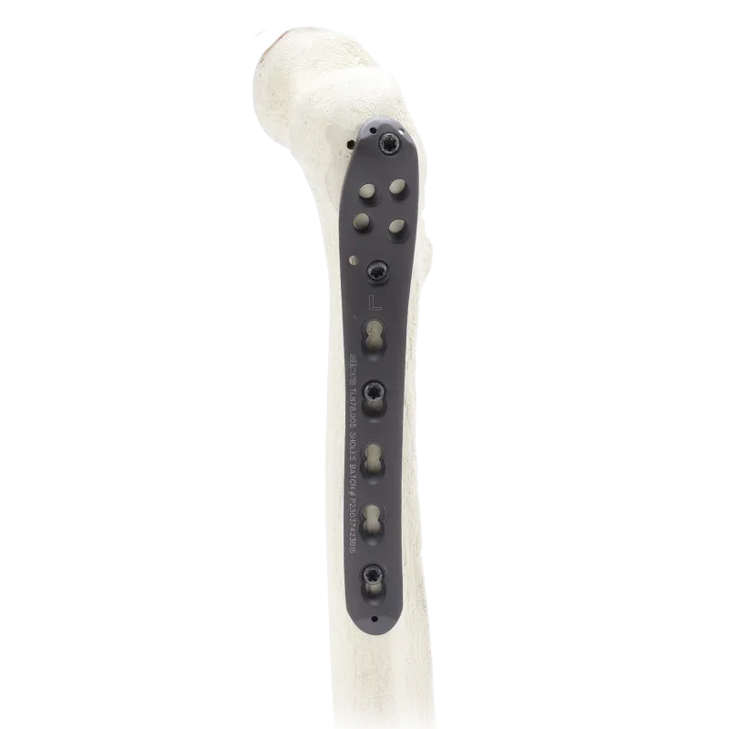 Locking Proximal Femur Plates