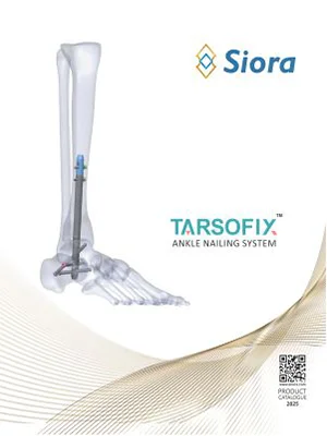 TARSOFIX Ankle Nailing System front
