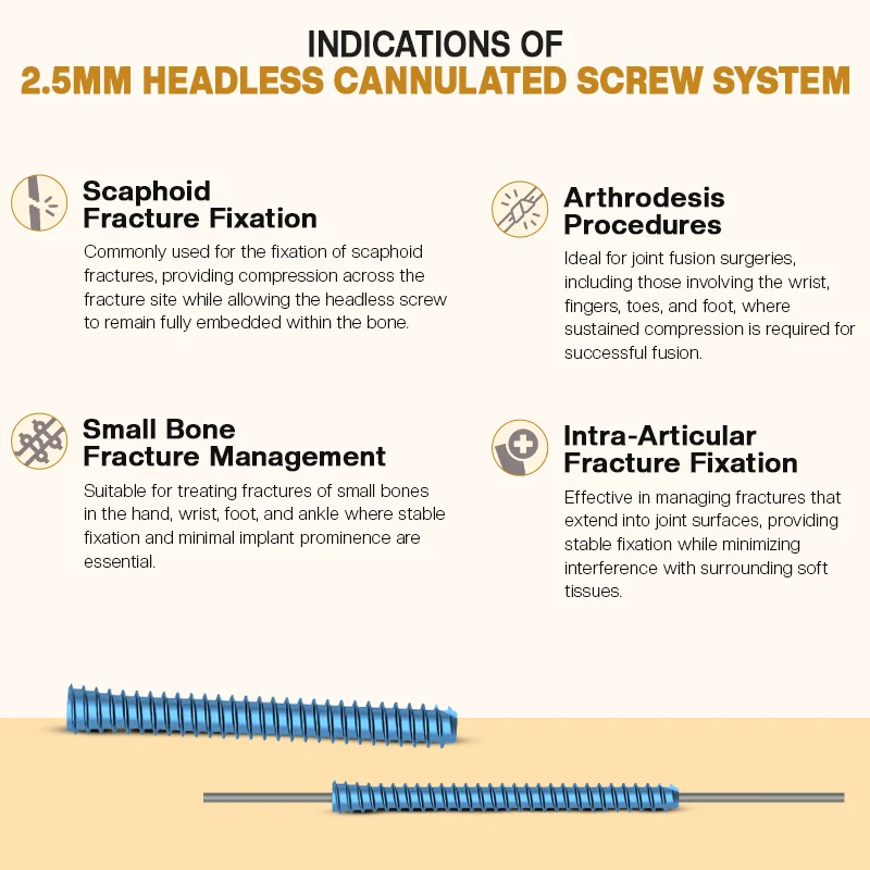Key Indications of the 2.5mm Headless Cannulated Screw System