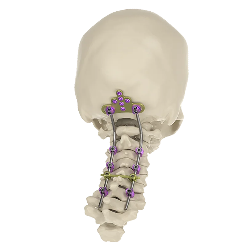 occipital spine